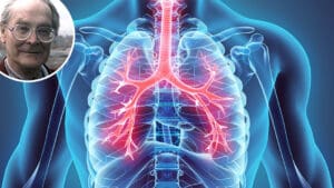 U jednom dahu - lijecenje astme prirodnim putem
