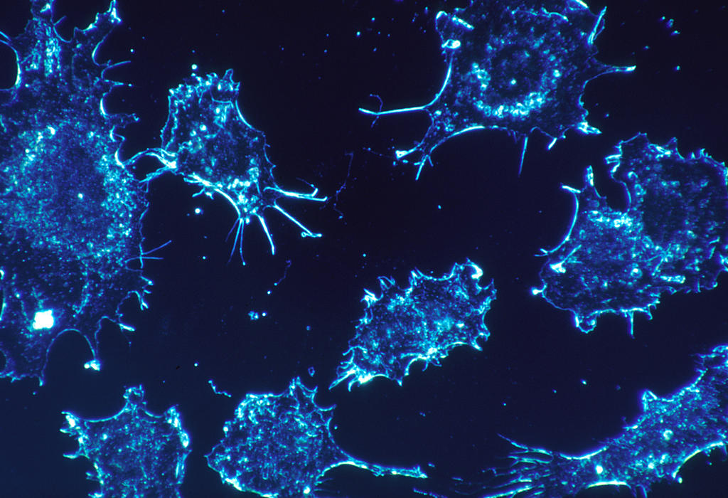 Rak - ćelije raka