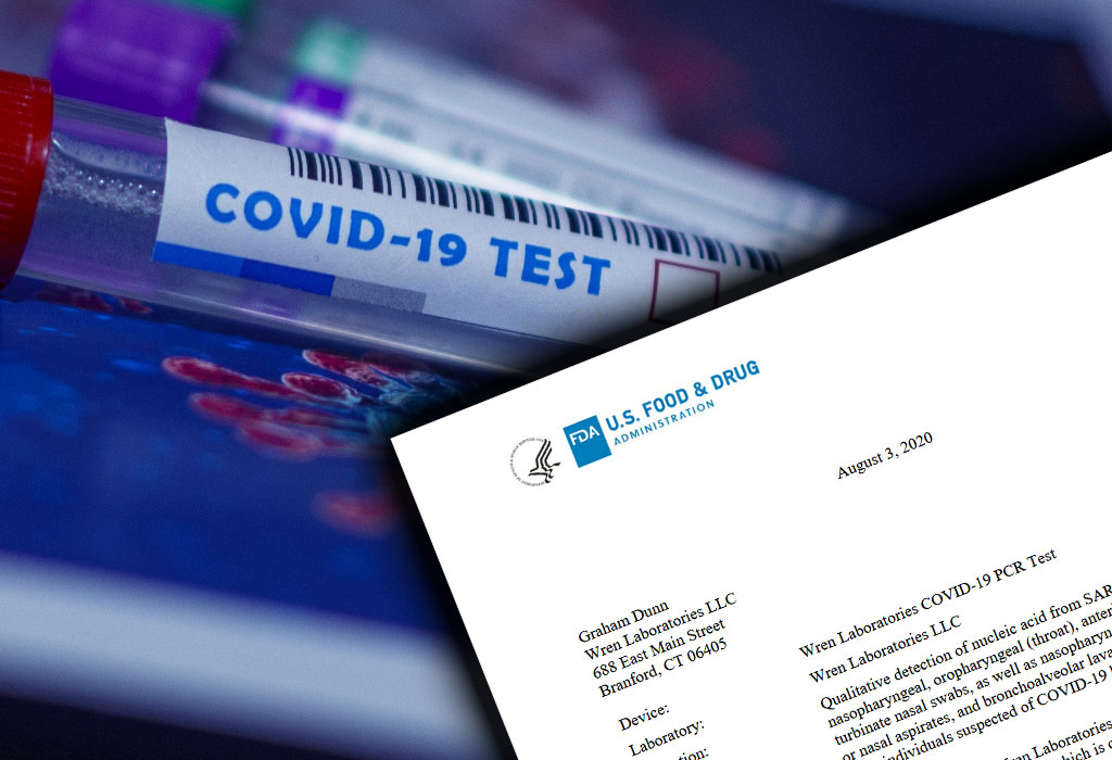 Covid 19 - Test