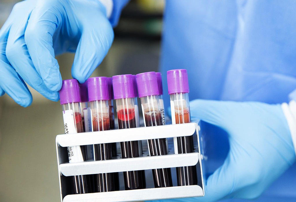 Dijagnostirati-rak-pomocu-kapljice-krvi