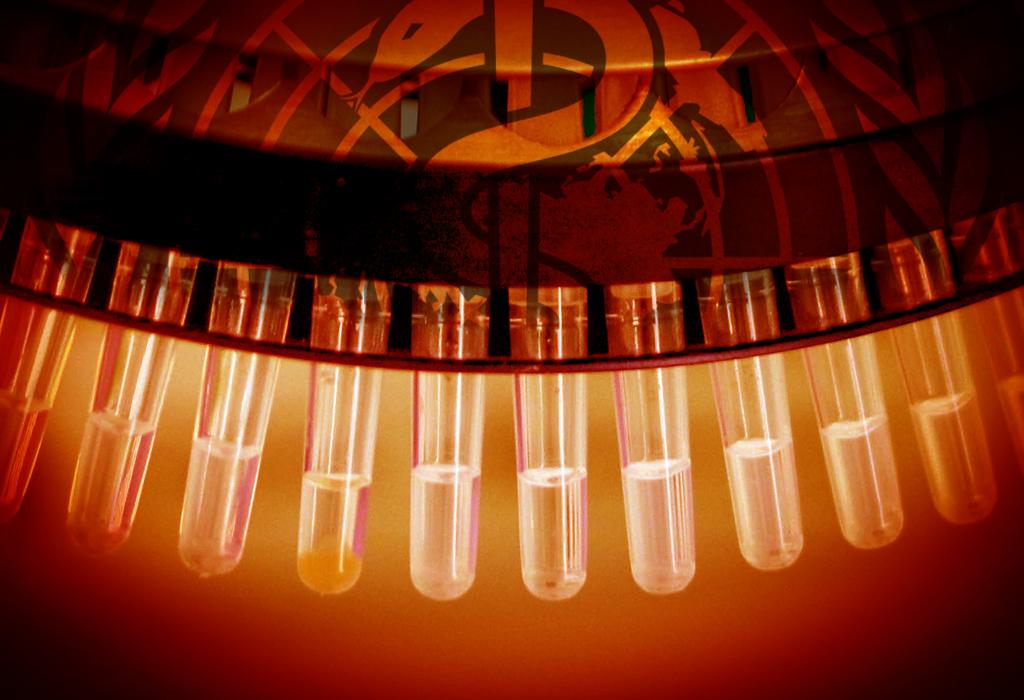 Pada PCR test