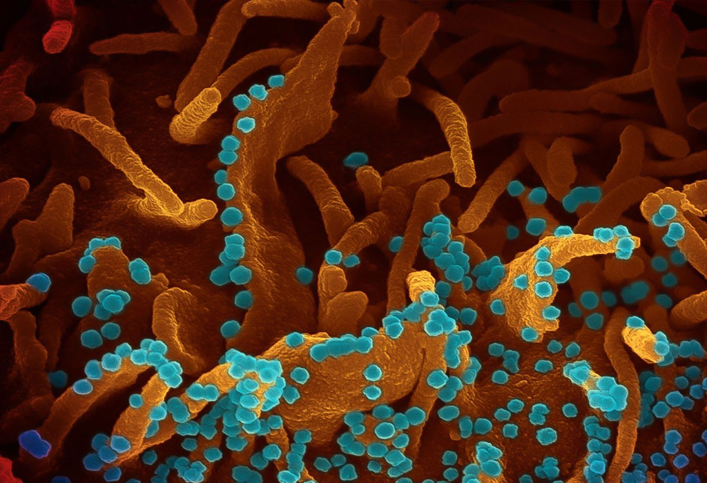 Virus pod mikroskopom