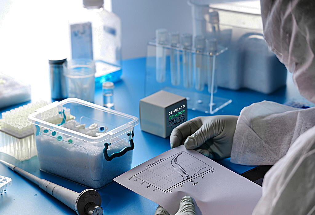 Istrazivanje o COVID-19