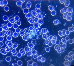 GRAFEN OKSID - Slika 1: Normalna krv, sa bijelom stanicom u sredini