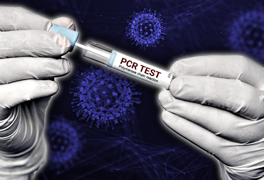 CDC više ne prepoznaje PCR test kao valjanu metodu za otkrivanje potvrđenih slučajeva Covid-19 1