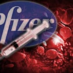 Pfizer vakcina nuspojave