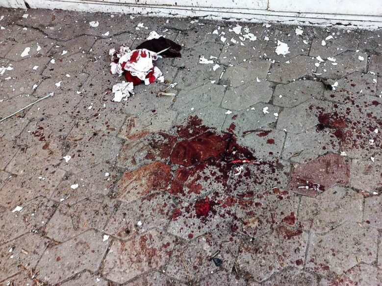 Ukrajinski napad na tržnicu Donjecka bio je teroristički akt... 2
