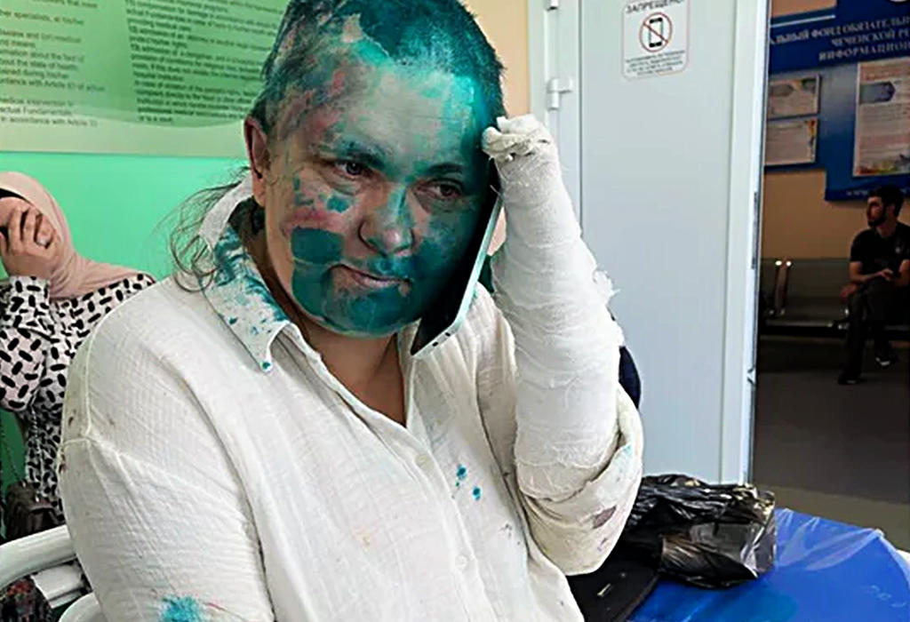 Napadnuta aktivistica u Čečeniji