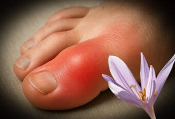 GIHT - Kolchicin - Jesenski mrazovac