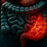Bolesti crijeva