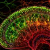 Alzheimerova bolest mijenja metabolizam i kisik u mozgu istovremeno